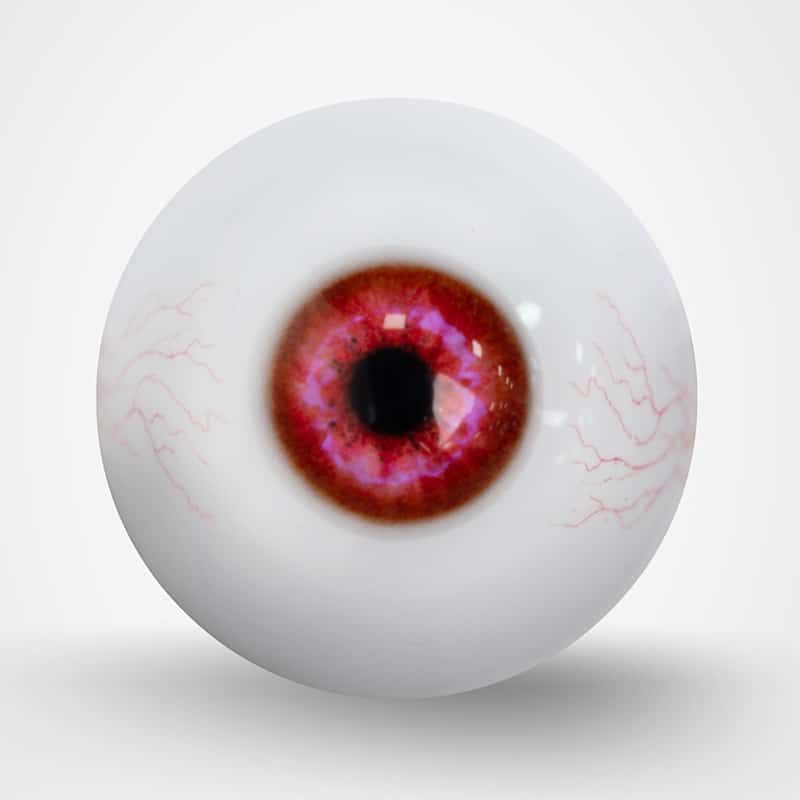 Cherry red bloodshot
