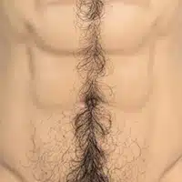 肚毛