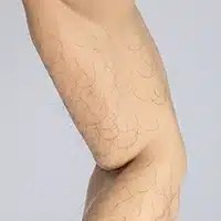 大臂毛
