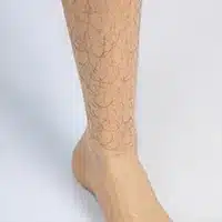 小腿毛